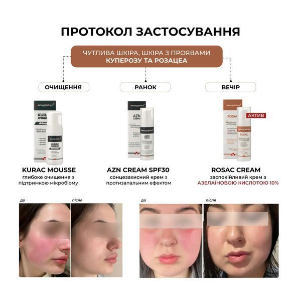 Заспокійливий крем для чутливої шкіри Braderm Rosac Cream 30 ml 000645547895 фото