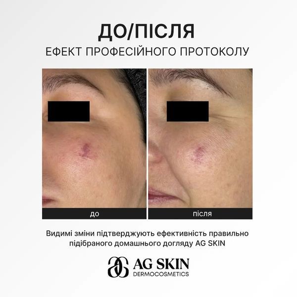ANTI-REDNESS SERUM СУДИНОЗМІЦНЮЮЧА СИРОВАТКА 30ml 0097963 фото