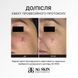 ANTI-REDNESS SERUM СУДИНОЗМІЦНЮЮЧА СИРОВАТКА 30ml 0097963 фото 2
