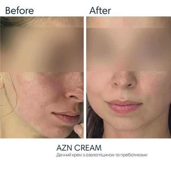 Сонцезахисний крем з протизапальним ефектом Braderm Azn Cream 30 ml 00009878513 фото