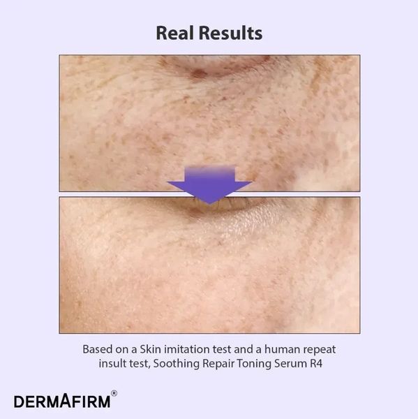 Мультифункціональна сироватка з бакучіолом - Soothing Repair Toning Serum R4 30 ml 000444543 фото