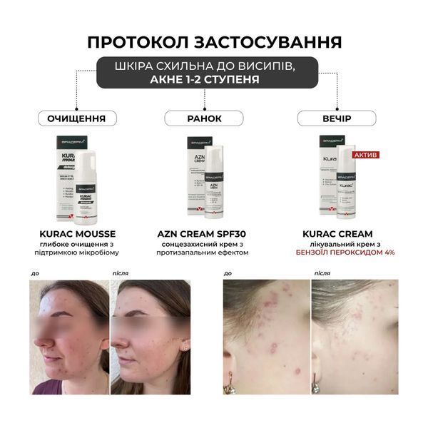 Активний протизапальний крем з бензоїл пероксидом 4% Braderm - Kurac Cream 30 ml 00298785442 фото
