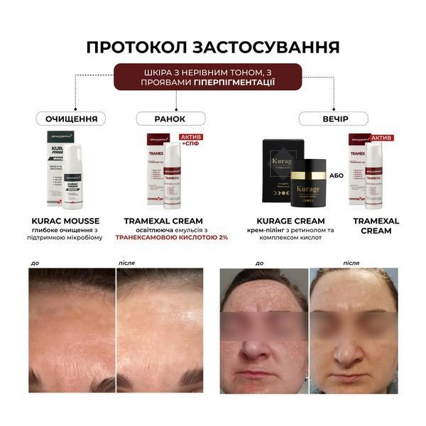 Освітлюючий крем проти пігментації Транексал Braderm Tramexal Cream 30 ml 000078753435 фото
