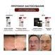 Освітлюючий крем проти пігментації Транексал Braderm Tramexal Cream 30 ml 000078753435 фото 2